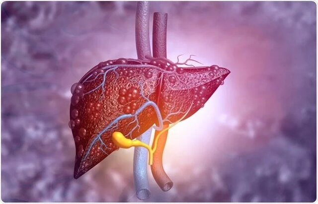 توسعه ترکیب ایمنی‌ درمانی جدید برای سرطان کبد
