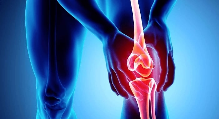 سن بروز آرتروز به جوانی رسید