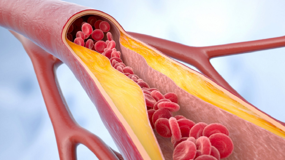 نوعی چربی در بدن که به تنظیم فشار خون کمک می‌کند