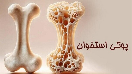 بعد از ۵۰ سالگی این گونه از استخوان ها و عضلات محافظت کنید