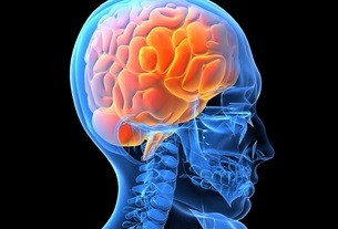 چه کار کنیم که سکته نکنیم؟