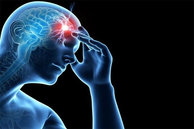 چند علامت مهم سکته مغزی