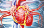افزایش موارد نارسایی قلبی مرتبط با متامفتامین در سراسر جهان