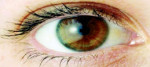 علائم و نحوه پیشگیری از آب سیاه چشم  را بدانید