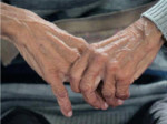 تغییر الگوی ابتلا به آلزایمر پس از کرونا